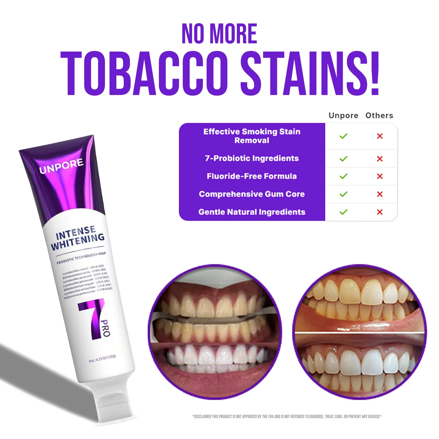 Unpore 7-Probiotic Purple Whitening Toothpaste